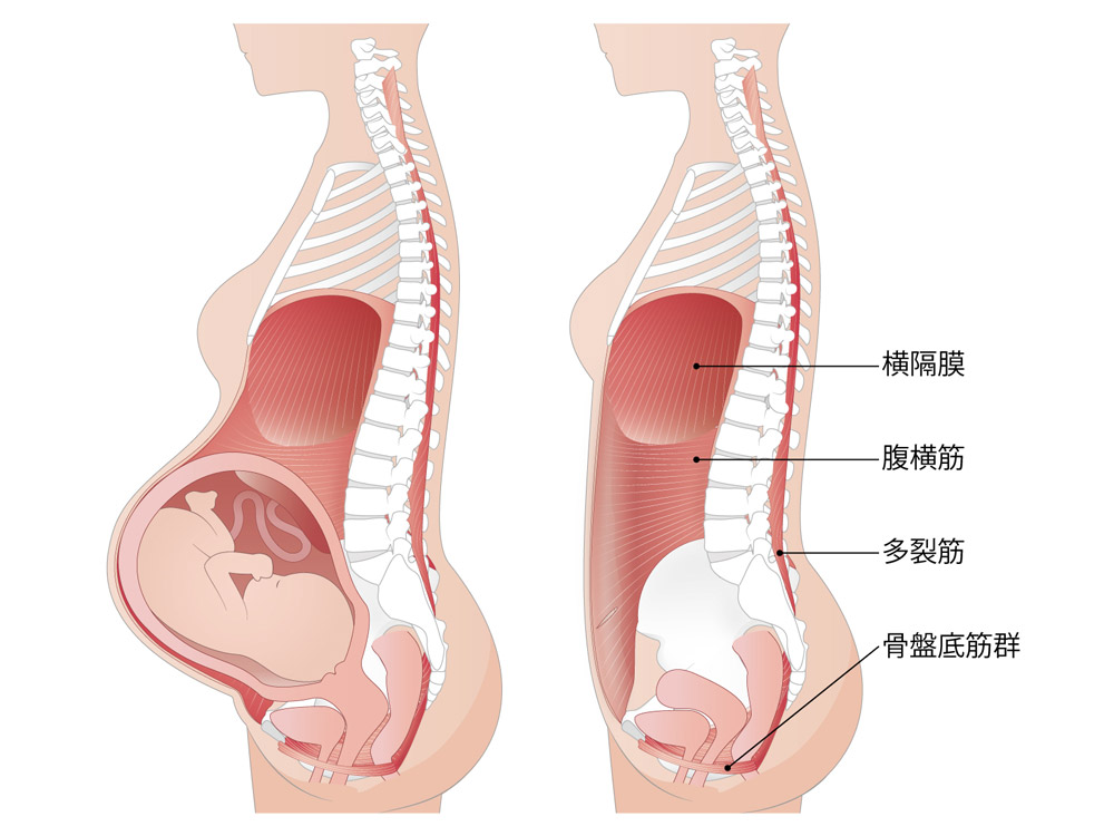 骨盤臓器脱の原因①：出産による筋力の低下・緩み