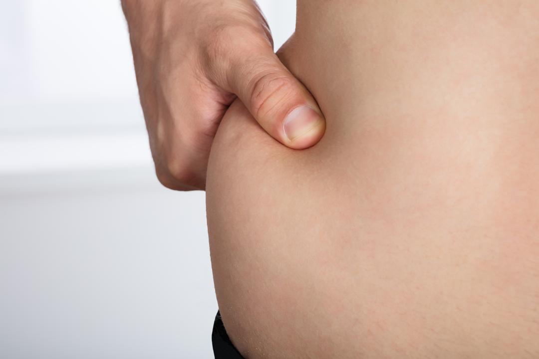 肥満は子宮脱、骨盤臓器脱になるリスクあり！？その理由と予防について解説