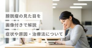 膀胱瘤の見た目を画像付きで解説｜症状や原因・治療法について